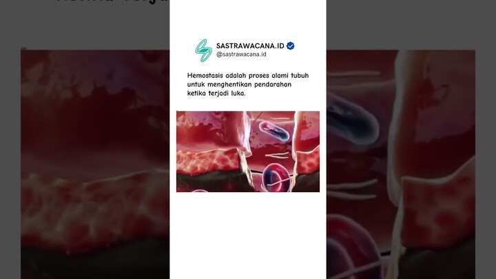 Hemostasis adalah proses alami tubuh menghentikan pendarahan ketika terjadi luka. #sastrawacana