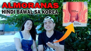 ALMORANAS o Hemorrhoids, PEDENG PEDE SA KOREA | paano gamutin? | AJ PAKNERS