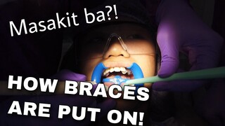 I GOT BRACES!! Pt.1 (Philippines) | Lady Pipay