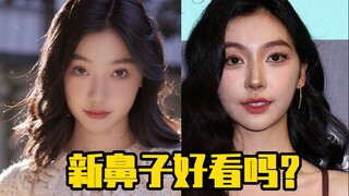 Yi Mengling: Apakah hidung barunya terlihat bagus?
