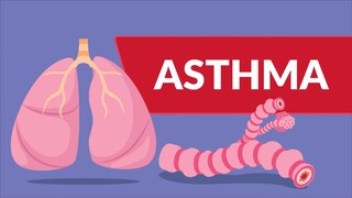 Asthma