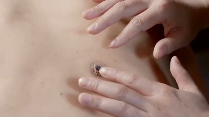 There was an odd wound on the boy’s back.