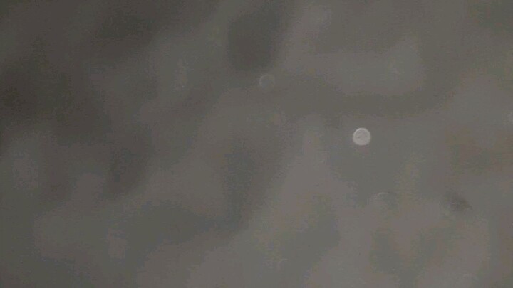 x video
