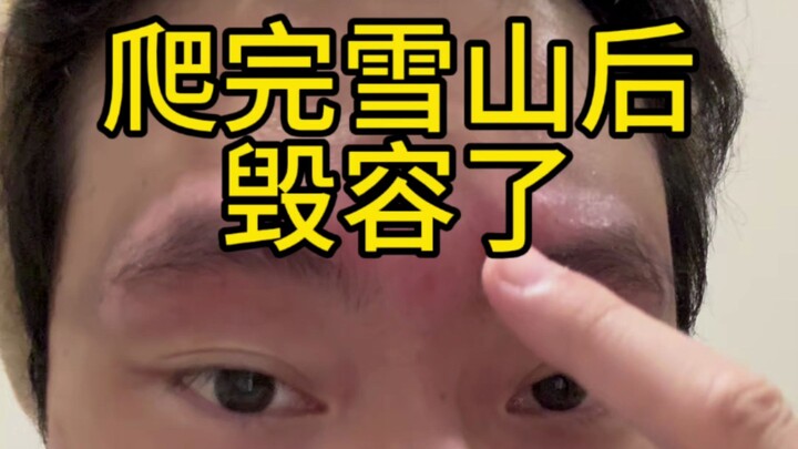 Sau khi leo núi tuyết xong, mặt tôi biến dạng luôn, đến vlog leo núi cũng chẳng còn tâm trạng để dựn