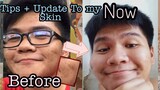 Road To Clear Skin pt.2 (Update + Tips) Kumikinis na !!!