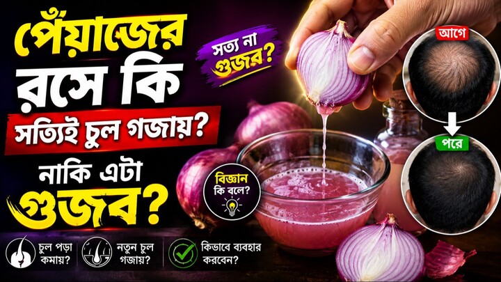 পেঁয়াজের রসে কি সত্যিই চুল গজায়? নাকি এটা গুজব?