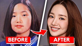 7 Korean Actors Who Were FORCED To Get Plastic Surgery