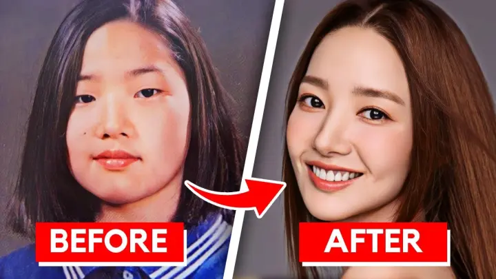 7 Korean Actors Who Were FORCED To Get Plastic Surgery