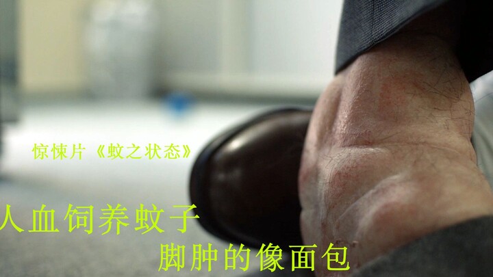 Inilah yang disebut orang tangguh! Membesarkan puluhan juta nyamuk dengan darah manusia, kaki bengka