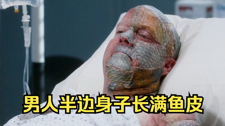 เงือกสาวฉบับเรียล ครึ่งหน้าของผู้ชายกลับเต็มไปด้วยเกล็ดปลา