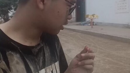 Vụ tai nạn xe đầu tiên, mất một chiếc răng