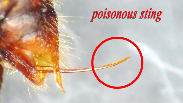 Pull Out The Stinger Under A Microscope