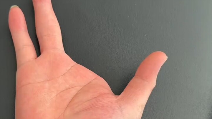 Goudu TV: Goudu memotong tangannya menjadi bentuk T-Rex