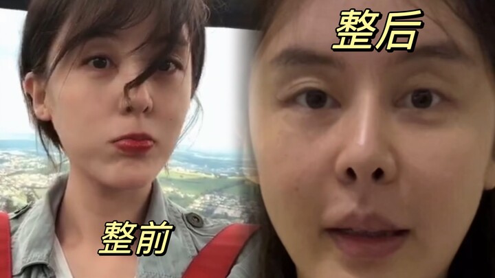 整容心酸史，姐妹们不要花钱变丑了！