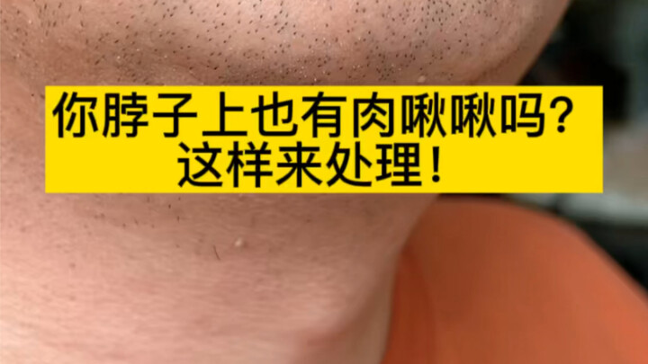 เนื้อบริเวณคอพุงยุบๆ จัดการแบบนี้เลย~