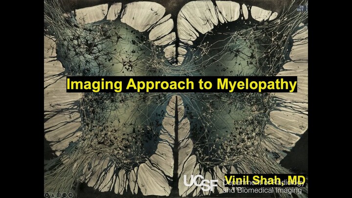 Imaging Approach to Myelopathy