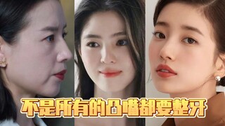 不是所有嘴凸都要整牙