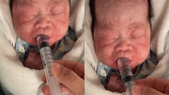 Em bé sinh ra bị đói đến mức hạ đường huyết, y tá dùng ống tiêm "cho bú" khiến cư dân mạng ngỡ ngàng