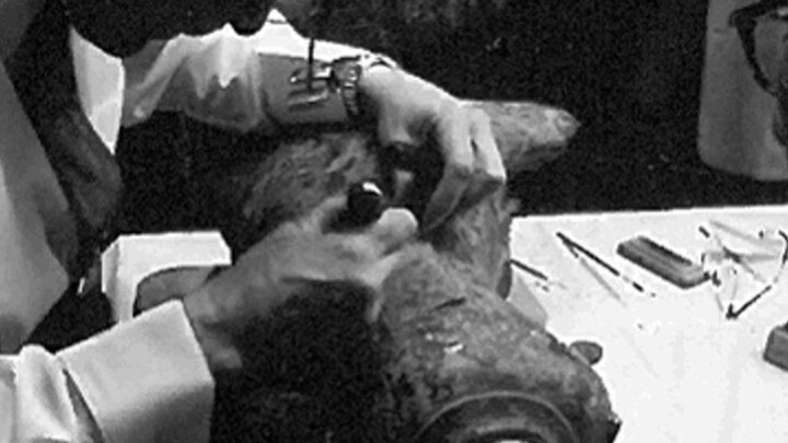 In 1957, a sharp scalpel sliced open the back of a Ming‑dynasty “little immortal.” An American colle
