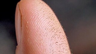 Thiếu niên cảm thấy có gì đó không ổn, trên tay mọc ra ngạnh, nằm ở trên tường còn có thể trèo lên!