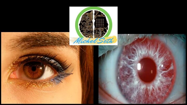 Eliminar melanina _ Elimination iris Audio subliminal creado en el 2013