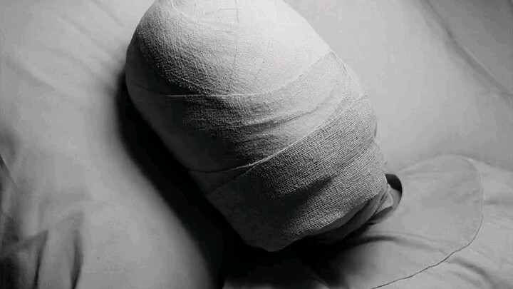 Người phụ nữ bị ép phẫu thuật thẩm mỹ 99 lần: Thất bại là bị tống vào trại tập trung quái vật – “Kỳ 