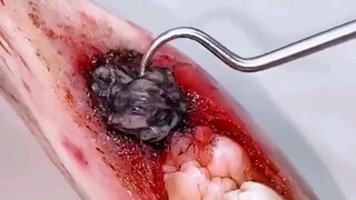 Đánh giá kem đánh răng quá đỉnh! Cứ tưởng rất hữu dụng hóa ra toàn là phí tiền ngu! Những mánh khóe 