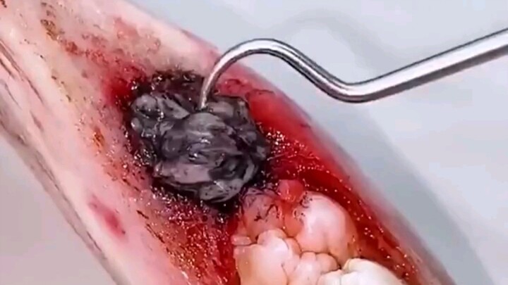 รีวิวยาสีฟันที่เด็ดมาก! นึกว่าใช้ดี ที่แท้ก็แค่ภาษีความโง่! กลโกงในยาสีฟันถูกเปิดโปงหมดแล้ว