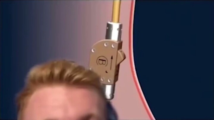 【Tasteless Joke】A new type of male contraceptive device...