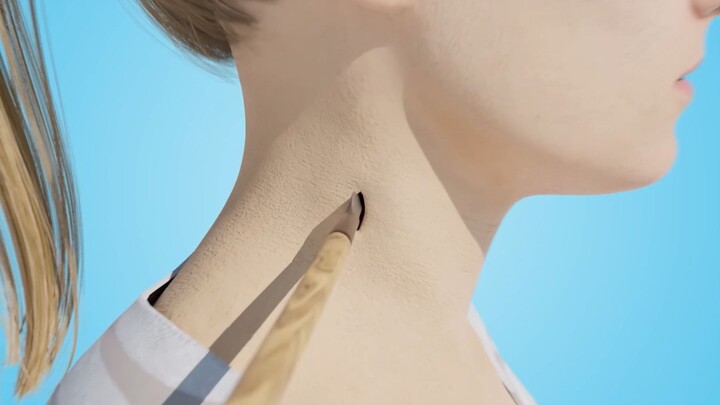 Tertembus panah di leher, tapi justru secara tak terduga menyelamatkan nyawanya