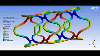 Stent Simulation_Biomechanics FEA_Biomedical Simulation