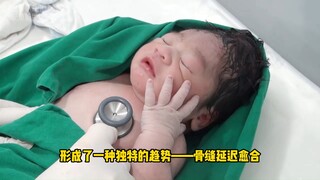 经过产道挤压的新生儿到底是什么样的？这头型不多见啊