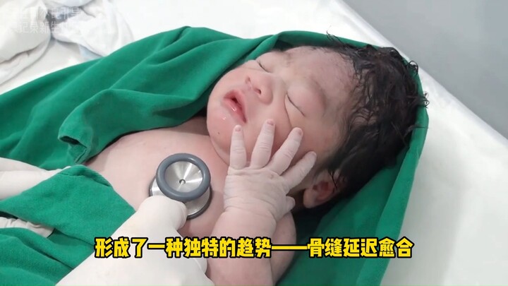经过产道挤压的新生儿到底是什么样的？这头型不多见啊