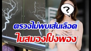 ดาราสาวโล่งใจ ตรวจไม่พบเส้นเลือดในสมองโป่งพอง