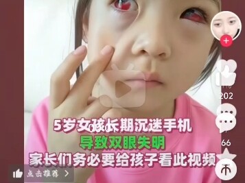 Families, will my eyes go blind?