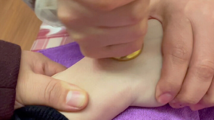 Fan hâm mộ ở Quảng An trị tuyệt chiêu u nang bao gân