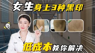 3 types of dark marks on girls—low-cost tips to help you easily get rid of them!