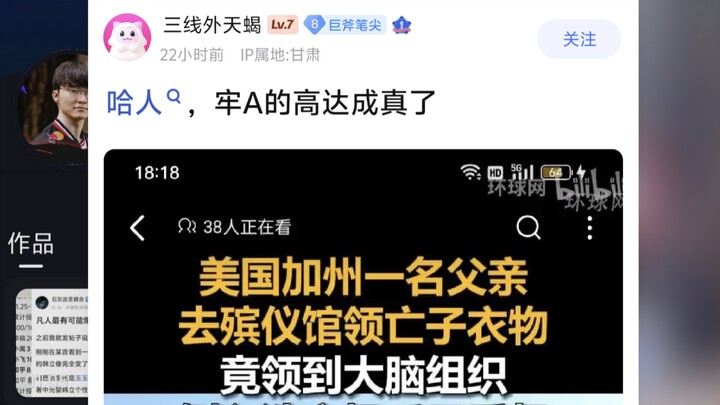 يا جماعة، نظرية أجزاء جاندام في السجن A أصبحت حقيقة: الأب استلم دماغ ابنه 🌸