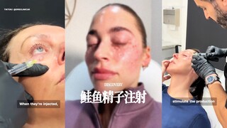 Gần đây, "tiêm * cá hồi" đang thịnh hành ở Âu Mỹ là gì⁉️