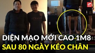 Khoa Pug khoe diện mạo mới cao 1m8 sau 80 ngày kéo dài chân