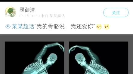 我的骨骼说…