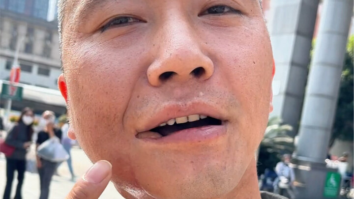 Cherish your oral health, stay away from betel nuts—never chew them! The warnings of those who came 