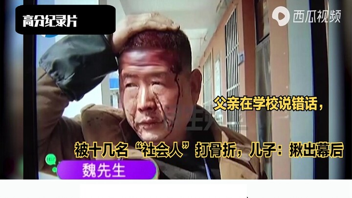 Father Says the Wrong Thing at School and Gets Beaten to a Pulp by a Dozen “Society Guys” — Son: I’l