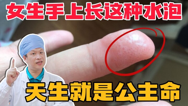 [Science Alert] Girls are born with a “princess destiny”—as the seasons change, these annoying blist