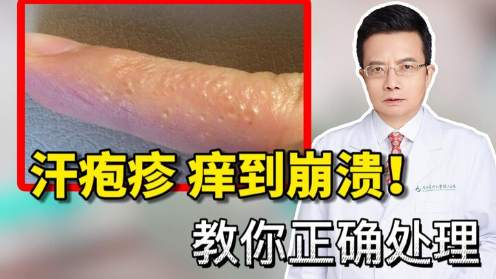 Ngứa ran như kim châm do tổ đỉa! Đừng gãi nữa, bác sĩ sẽ chỉ bạn cách xử lý đúng cách