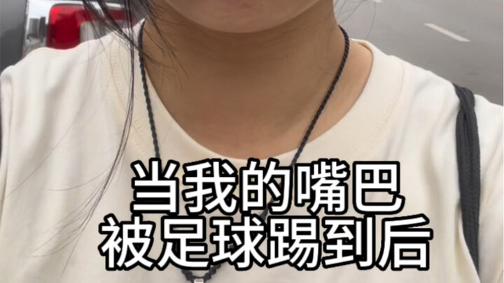 Bermain bola harus hati-hati