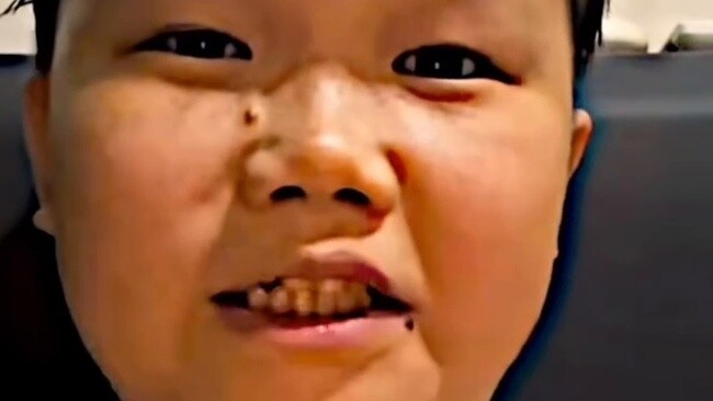 Sự tương phản