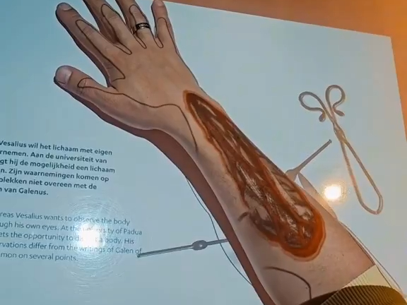 Are medical projectors really that advanced now?