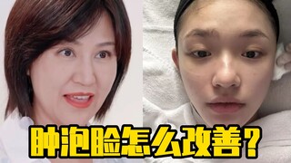 How to improve puffy face?
