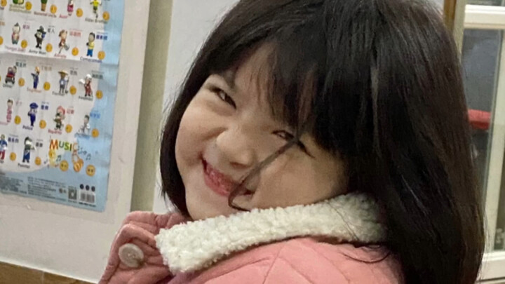 This 4-year-old girl has two faces…